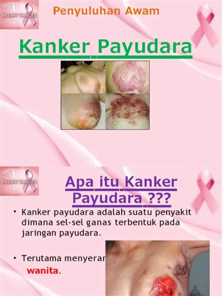 Apakah wanita Virgo cocok dengan pria Cancer?