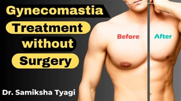 Are there any gynecomastia?
