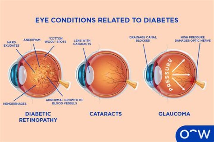 Can Hormonal changes cause eye problems?