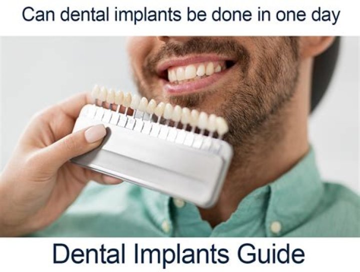 Can implants be done in one day?