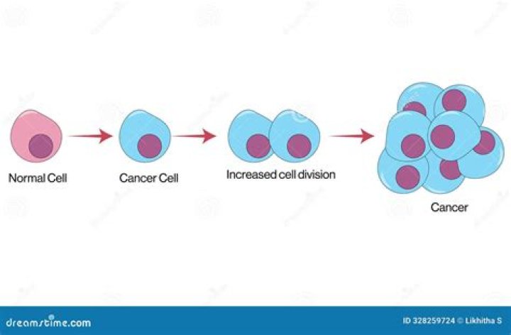 Can my endometriosis turn into cancer?