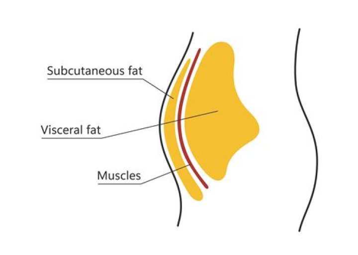 How do I get rid of excess subcutaneous fat?