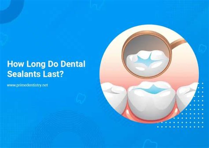 How long do Ozonics last?