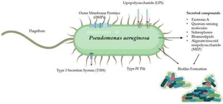 How pseudomonas aeruginosa is transmitted?