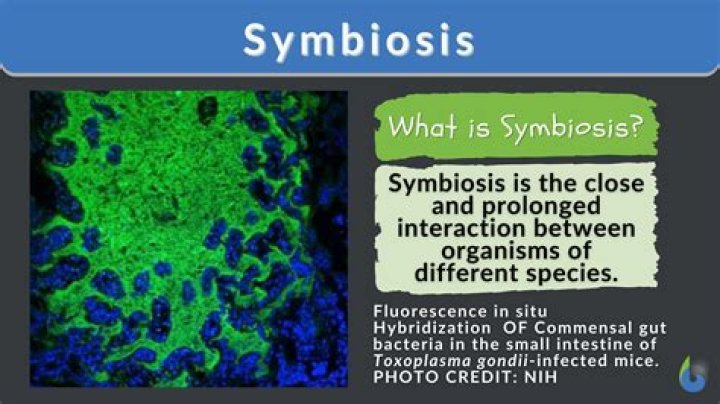 Is symbiosis private university?