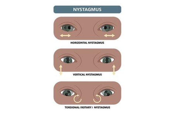 What is horizontal gaze nystagmus?