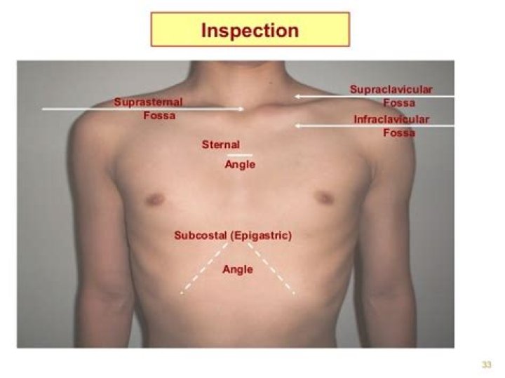 What is Subcostal angle?