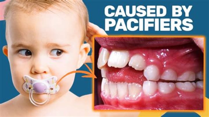When should I use big pacifier?
