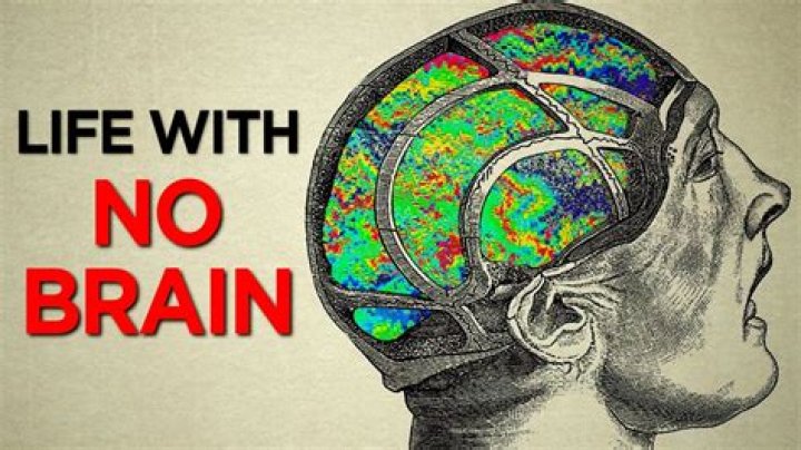 Who has no brain?
