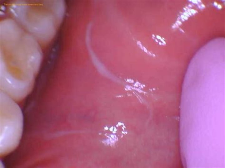 Why do I get a film in my mouth after brushing my teeth?